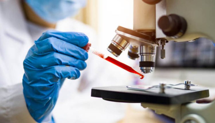 cancer treatment Redmond WA